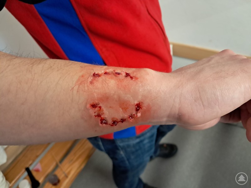 Wenn das Schminkteam mit Biss ganze Arbeit geleistet hat, dann sind auch gute Nerven und beherztes Zupacken gefragt. Nahaufnahme eines verletzten Arms mit geschminkter Wunde, die einen Hundebiss simuliert.